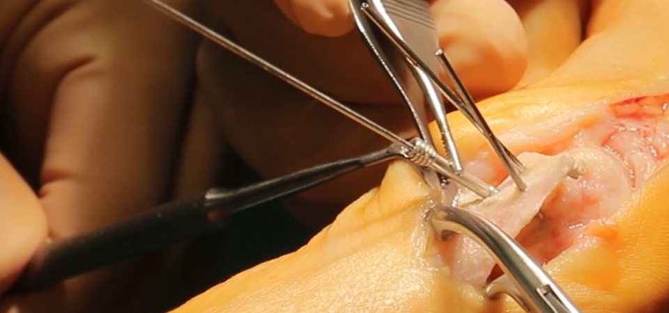 orthopedic surgery in bilaspur